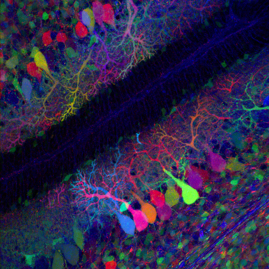 Neurons labeled by Brainbow techology.

Transgenic Brainbow lines show co-expression of multiple colors in individual cells. Notably, a large number of different hues are observed. In a confocal microscope stack through a peripheral motor nerve, for instance, we can distinguish at least ten combinations in different axons. (Livet J, et al. Transgenic strategies for combinatorial expression of fluorescent proteins in the nervous system. Nature. 2007. 450(7166): 56-62.)