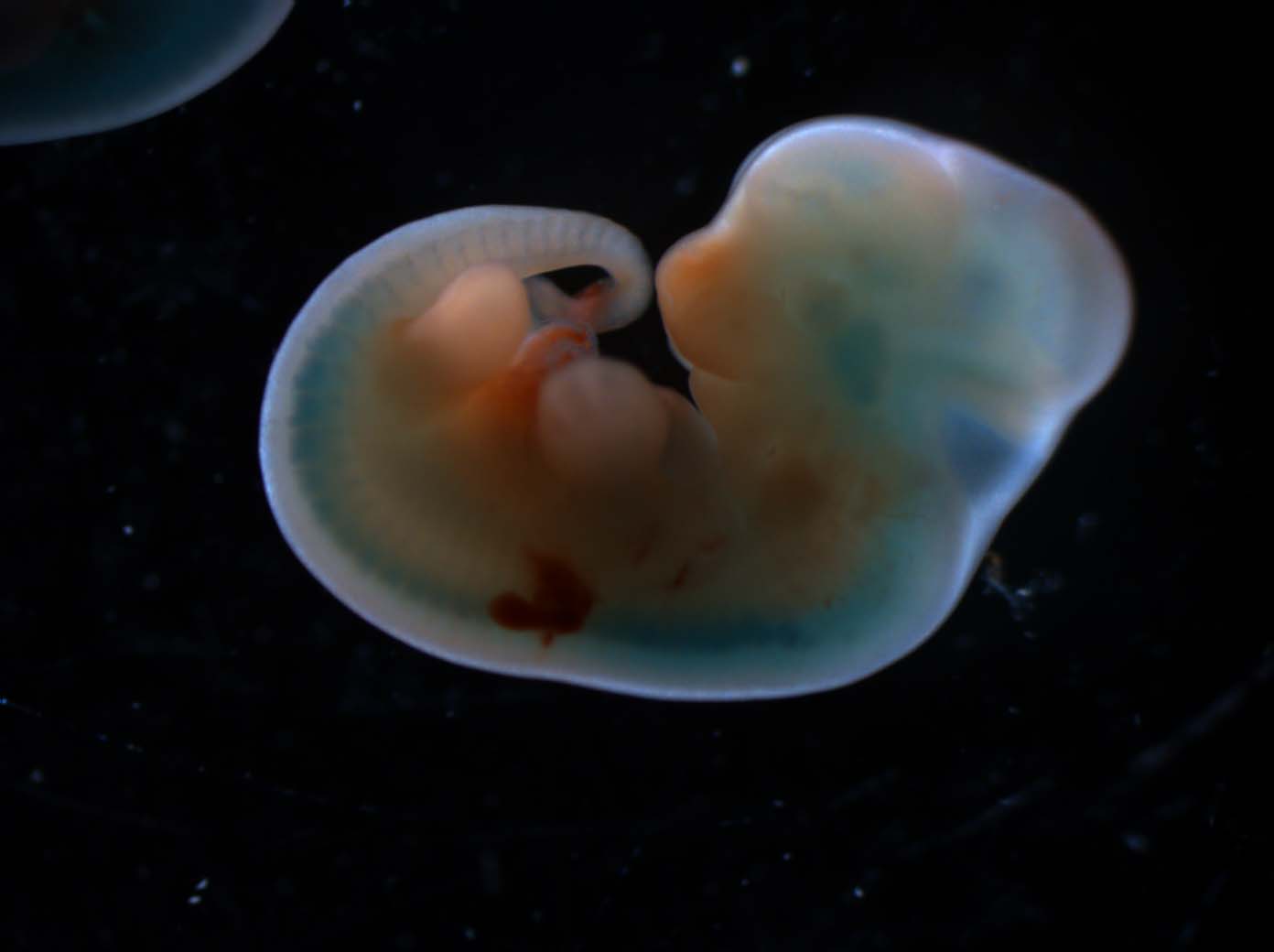 A mouse embryo carrying a piggyBac transgene with a lacZ gene trap cassette.